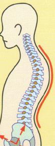 湾曲した背骨
